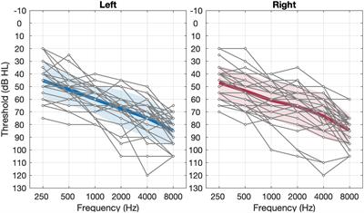 Effects of Adaptive Non-linear Frequency Compression in Hearing Aids on Mandarin Speech and Sound-Quality Perception